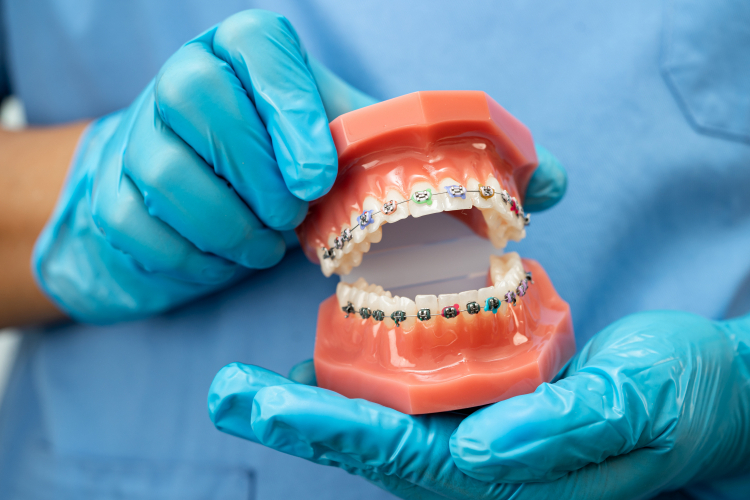 denture-dentist-holding-dental-teeth-model-to-stu-2025-02-25-15-56-19-utc (1) (1) (1)